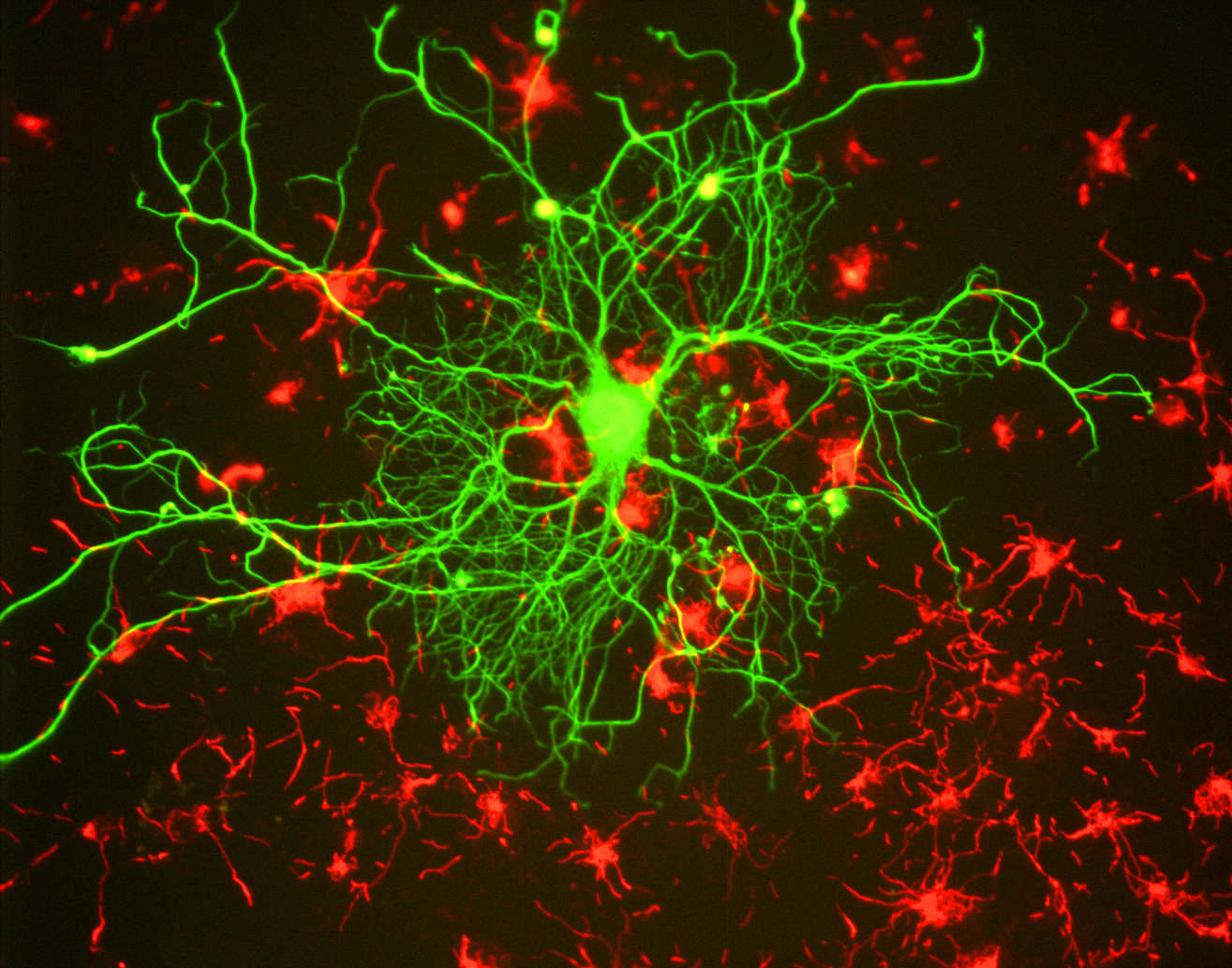 La Neuro-Hypnose : nos neurones tissant des liens.